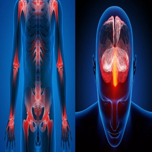 Extreme Multiple Chemical Sensitivities